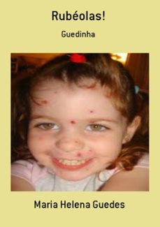 rubéolas! (ebook)-maria helena guedes-3410001859908