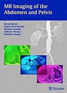 mr imaging of the adomen and pelvis-9783131455918