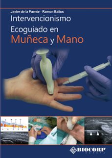 intervencionismo ecoguiado en mano y muñeca-ramon balius-9788409433018