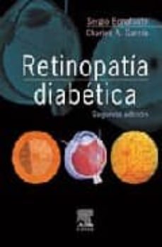 retinopatia diabetica-sergio bonafonte-9788481741018