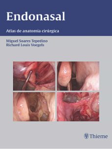 endonasal (ebook)-9788567661018
