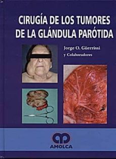 cirugia de los tumores de la glandula parotida-jorge a. guerrisi-9789588328218