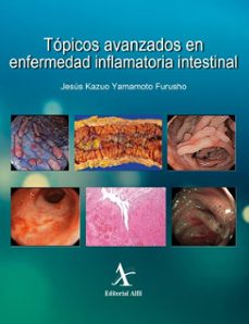 topicos avanzados en enfermedad inflamatoria intestinal (ebook)-jesús kazuo yamamoto furusho-9786077416128