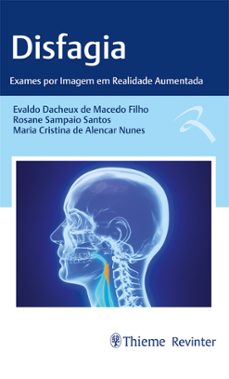 disfagia (ebook)-evaldo dacheux de macedo filho-rosane sampaio santos-maria cristina de alencar nunes-9786555722628