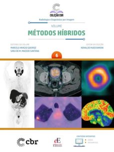volume 6 - metodos hibridos (ebook)-marcelo araújo queiroz-sara de melo macedo santana-ronaldo hueb baroni-9786561031028