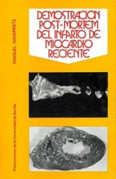 demostracion post-mortem del infarto de miocardio reciente-manuel navarrete ortega-9788474050028