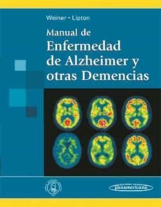 manual de enfermedad de alzheimer y otras demencias-myron f. weiner-anne m. lipton-9788498353228