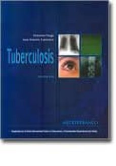 tuberculosis (3ª ed.)-v. farga-9789562203128
