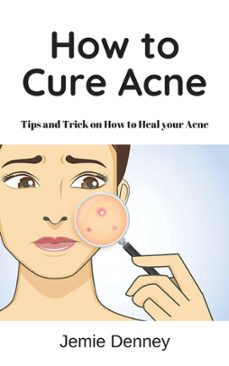 how to cure acne-jessica lindsey-9781386655138