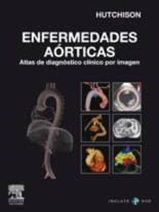 enfermedades aorticas: atlas de diagnostico clinico por imagen + dvd-rom-9788480866538