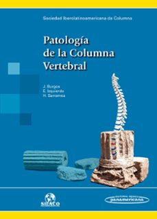 patologia de la columna vertebral.-9788491100348