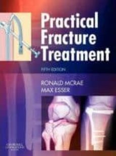practical fracture treatment-ronald mcrae-9780443068768