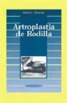 artroplastia de rodilla-j.m. ordoñez-9788479032968