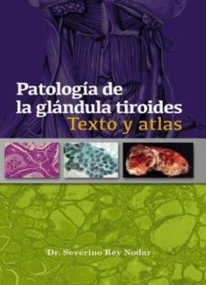 patologia de la glandula tiroides texto y atlas (digital) (ebook)-severino rey nodar-9788468614878