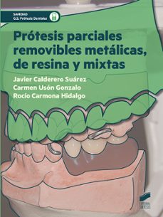 protesis parciales removibles metalicas, de resina y mixtas-9788491710288