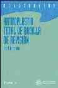 artroplastia total de rodilla de revision-leo a. whiteside-9788495670588