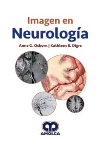 imagen en neurologia-anne g. osborn-kathleen b. digre-9789585426788