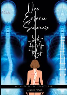 une enfance scolereuse (ebook)-9782322665198