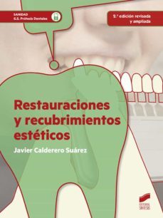 restauraciones y recubrimientos esteticos (2ª edicion revisada y ampliada) (ebook)-javier calderero suarez-9788491718598
