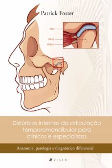 distúrbios internos da articulação temporomandibular para clínicos e especialistas (ebook)-patrick foster-9788530004798