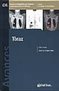avances en diagnostico por imagenes (vol. 2): torax-jose luis criales-9789871259298