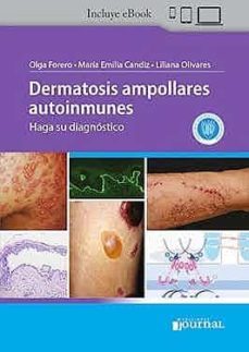dermatosis ampollares autoinmunes (incluye ebook)-olga forero-maria emilia candiz-liliana olivares-9789878452098