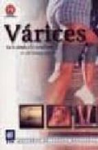 Top descarga gratuita de audiolibros Varices: de lo simple a lo complicado