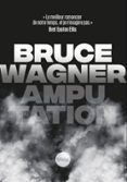 AMPUTATION