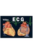 e.c.g. electrocardiografia (3ª ed.)-9788416042418 e.c.g. electrocardiografia (3ª ed.)-9788416042418