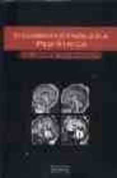 Libros en línea descargar mp3 gratis NEUROIMAGENOLOGIA PEDIATRICA de JAMES A. BARKOVICH CHM