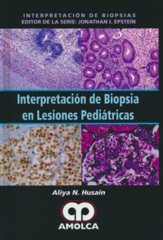 Ebooks rar descargar gratis INTERPRETACION DE BIOPSIA EN LESIONES PEDIATRICAS 9789588950068 (Spanish Edition) de ALIYA N. HUSAIN
