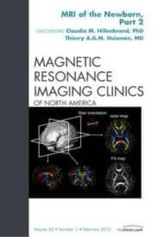 Descarga de agenda electrónica MRI OF THE NEWBORN, PART 2, AN ISSUE OF MAGNETIC RESONANCE IMAGIN G CLINICS, VOLUME 20-1 ePub PDF 9781455738878