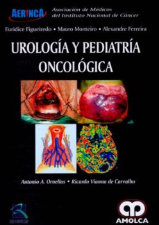 Ibooks descarga gratis UROLOGIA Y PEDIATRIA ONCOLOGICA de ANTONIO AUGUSTO ORNELLAS  en español 9789585426078