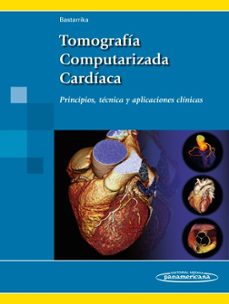 Portada de TOMOGRAFIA COMPUTARIZADA CARDIACA: PRINCIPIOS, TECNICA Y APLICACIONES CLINICAS